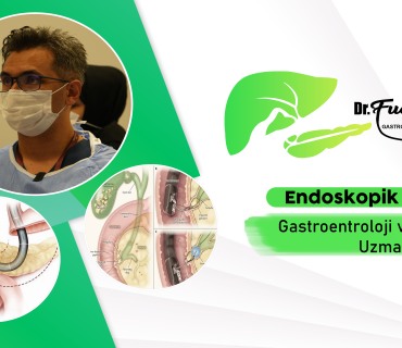 Gastroenteroloji, Sindirim sistemi hastalıkları, Mide sağlığı, Bağırsak hastalıkları, Karaciğer sağlığı, Pankreas hastalıkları, Safra kesesi, Reflü hastalığı, İrritabl bağırsak sendromu (IBS), Mide ülseri, Hepatit, Kolit tedavisi, Crohn hastalığı, İnflamatuar bağırsak hastalıkları, Karaciğer iltihabı, Pankreatit tedavisi, Sindirim sistemi sorunları, Gastroenterolog, Kolonoskopi, Endoskopi, Gastrointestinal sağlık, Sindirim bozuklukları, Bağırsak florası, Mide ekşimesi, Karaciğer hastalıkları, Safra taşı tedavisi, Kolon kanseri taraması, Sindirim sistemi tedavisi, Mide asiditesi, Gastroenteroloji uzmanı.