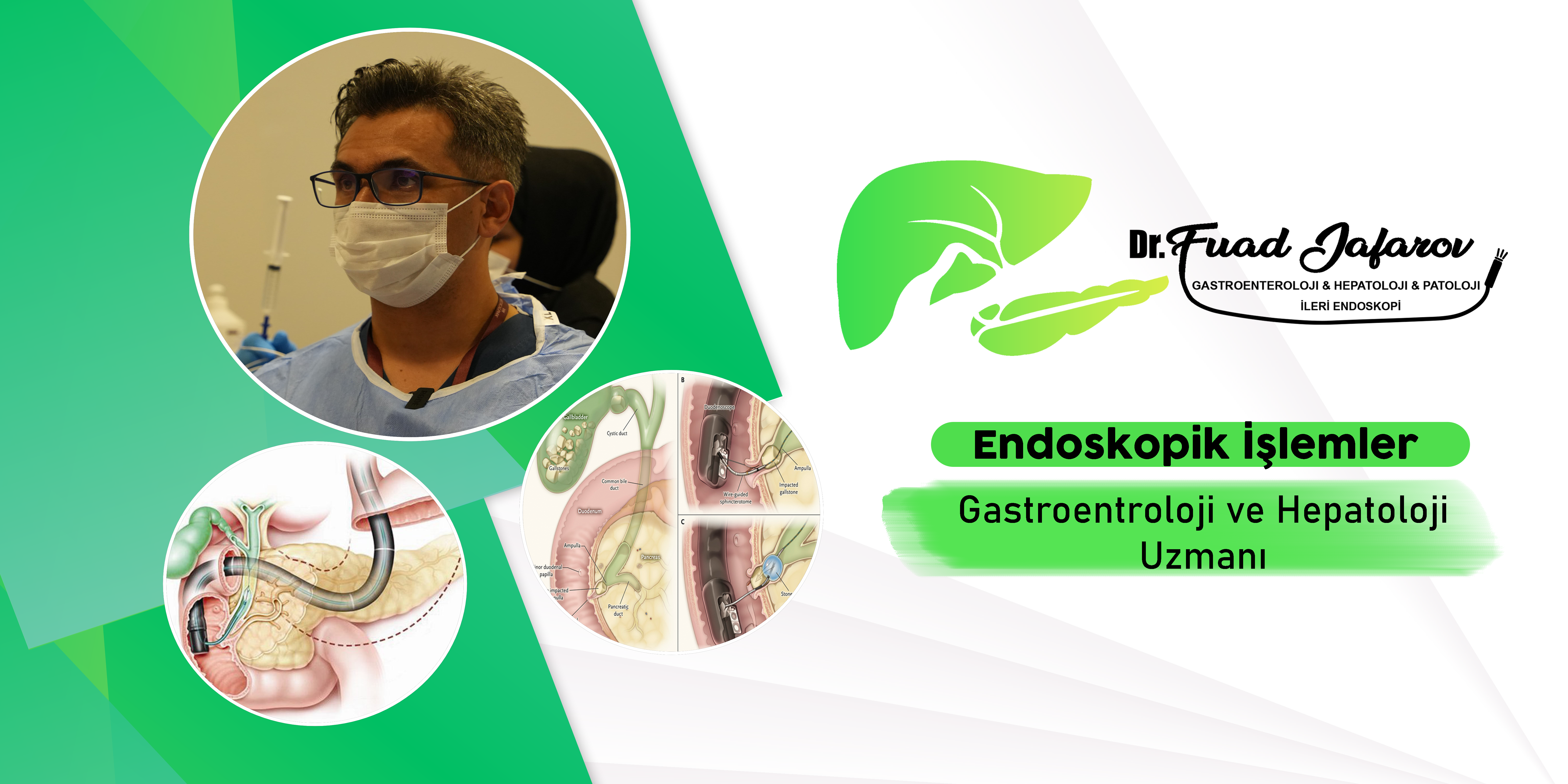 Gastroenteroloji, Sindirim sistemi hastalıkları, Mide sağlığı, Bağırsak hastalıkları, Karaciğer sağlığı, Pankreas hastalıkları, Safra kesesi, Reflü hastalığı, İrritabl bağırsak sendromu (IBS), Mide ülseri, Hepatit, Kolit tedavisi, Crohn hastalığı, İnflamatuar bağırsak hastalıkları, Karaciğer iltihabı, Pankreatit tedavisi, Sindirim sistemi sorunları, Gastroenterolog, Kolonoskopi, Endoskopi, Gastrointestinal sağlık, Sindirim bozuklukları, Bağırsak florası, Mide ekşimesi, Karaciğer hastalıkları, Safra taşı tedavisi, Kolon kanseri taraması, Sindirim sistemi tedavisi, Mide asiditesi, Gastroenteroloji uzmanı.